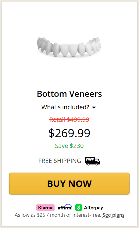 Shiny Smile Veneers 14