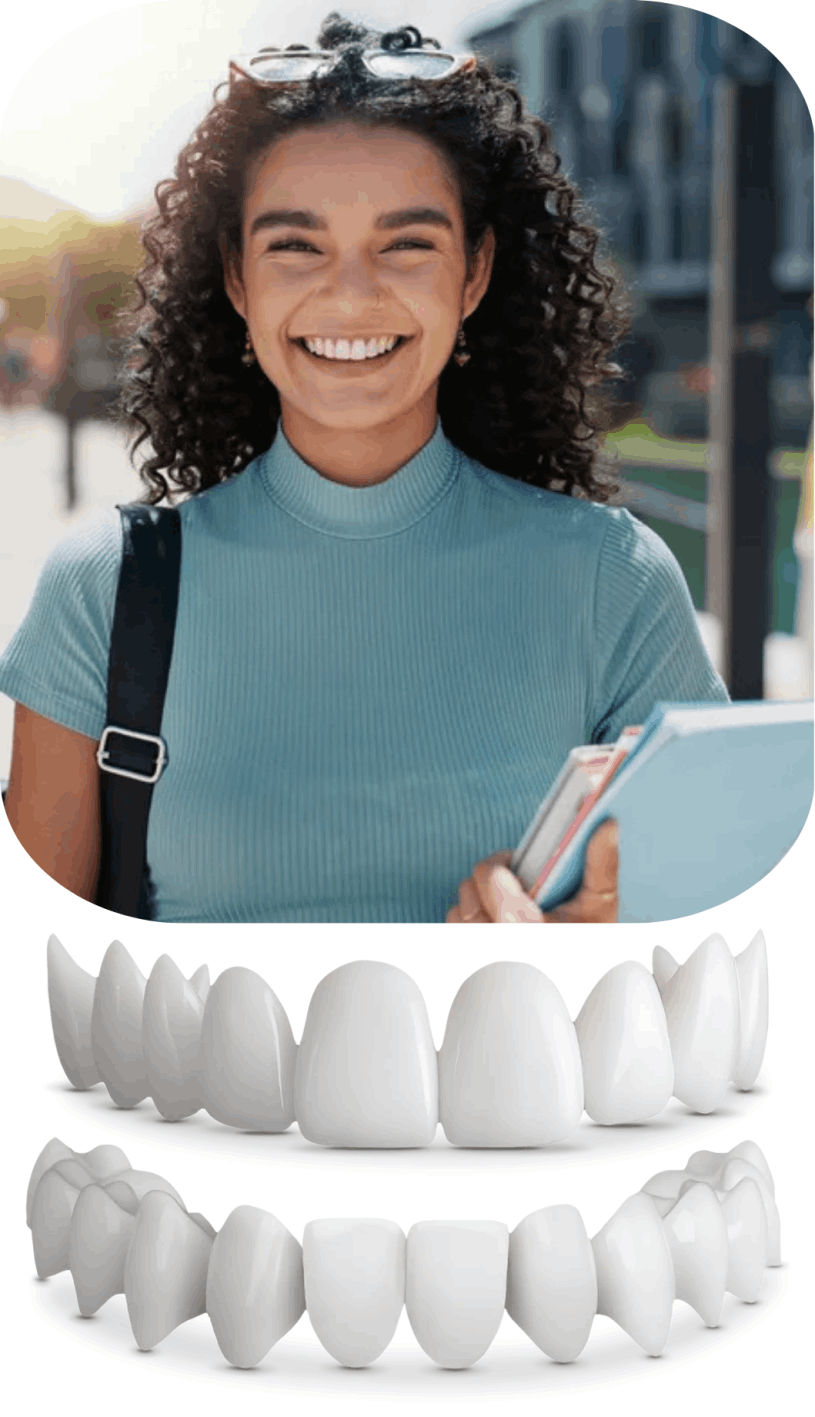 Shiny Smile Veneers 10